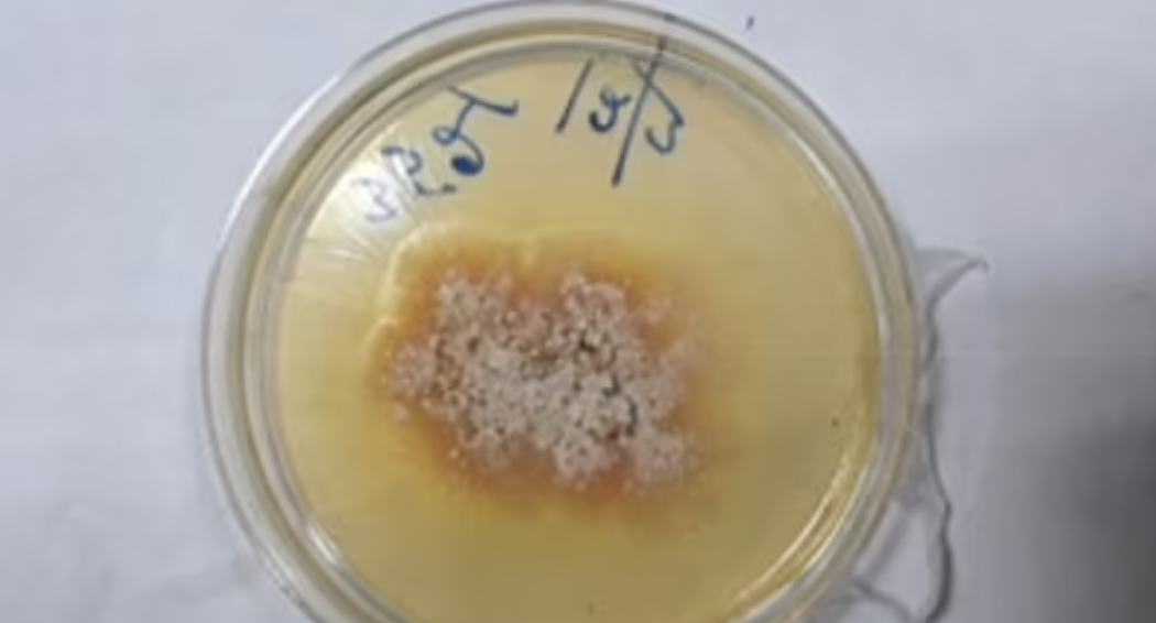 Зареєстровано перший випадок "нападу" грибкового захворювання рослин на людину