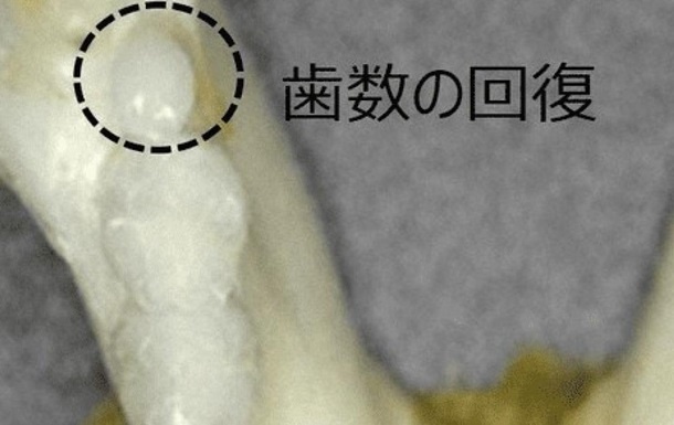 Японські вчені успішно відростили втрачені зуби