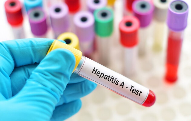 Вспышка гепатита А в Винницкой области: количество госпитализированных возросло