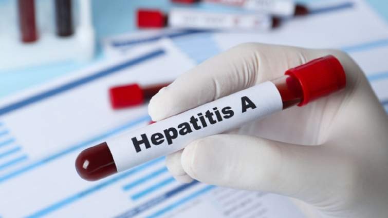 Вспышка гепатита А: введут ли карантин из-за болезни Боткина