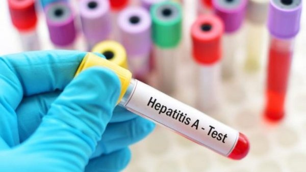 Главные мифы о гепатите: инфекционист рассказал подробности о болезни