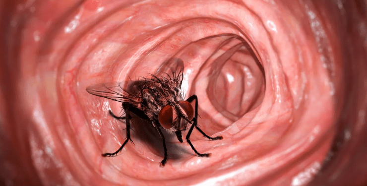 Во время колоноскопии врачи обнаружили в желудке человека живую жужжащую муху