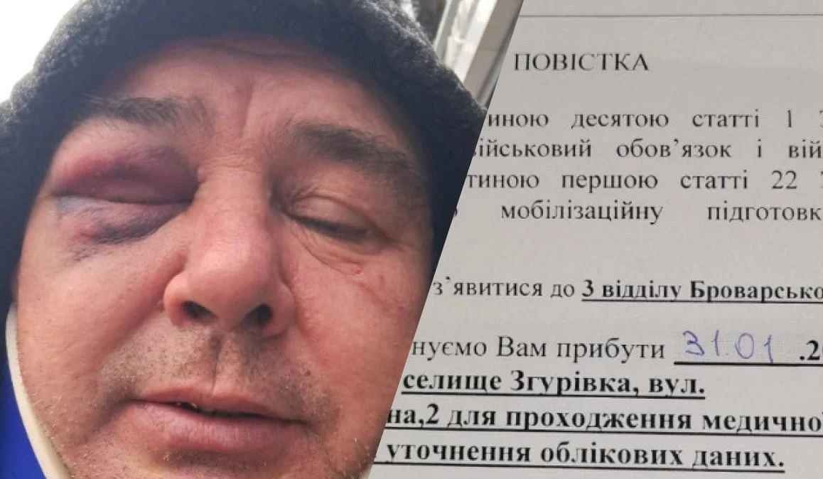 Полиция никак не реагировала: под Киевом неизвестные с ТЦК жестоко избили водителя-дальнобойщика