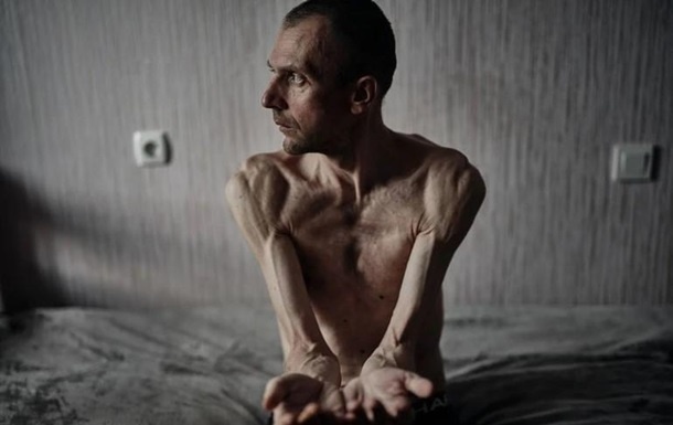 "Самая тяжелая наша съемка": фотографы опубликовали снимки украинских военных, находившихся в плену