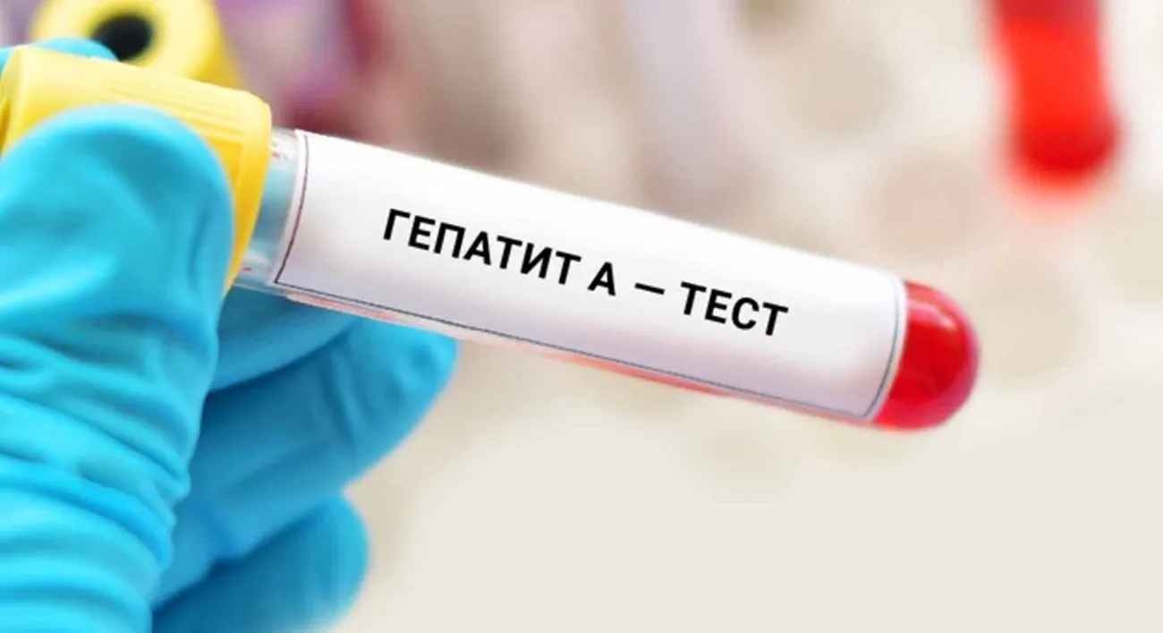 Вспышка гепатита А в Киеве: сколько людей болеет