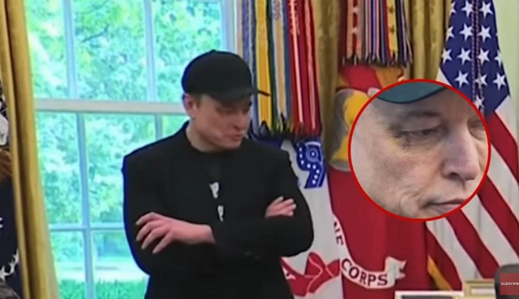 ЗМІ дізналися, як у Маска з'явився синець під оком
