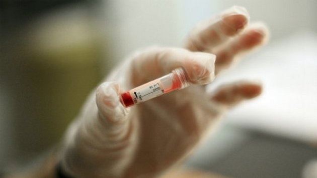 У США представили 100-відсотково працюючу вакцину від ВІЛ