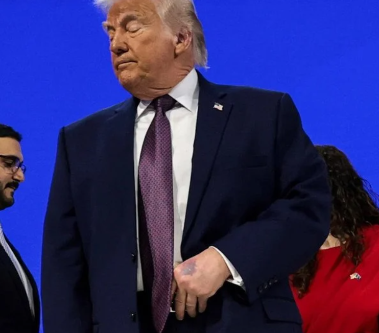 Плями на руках Трампа з'явилися знову: що цього разу сказали у Білому домі